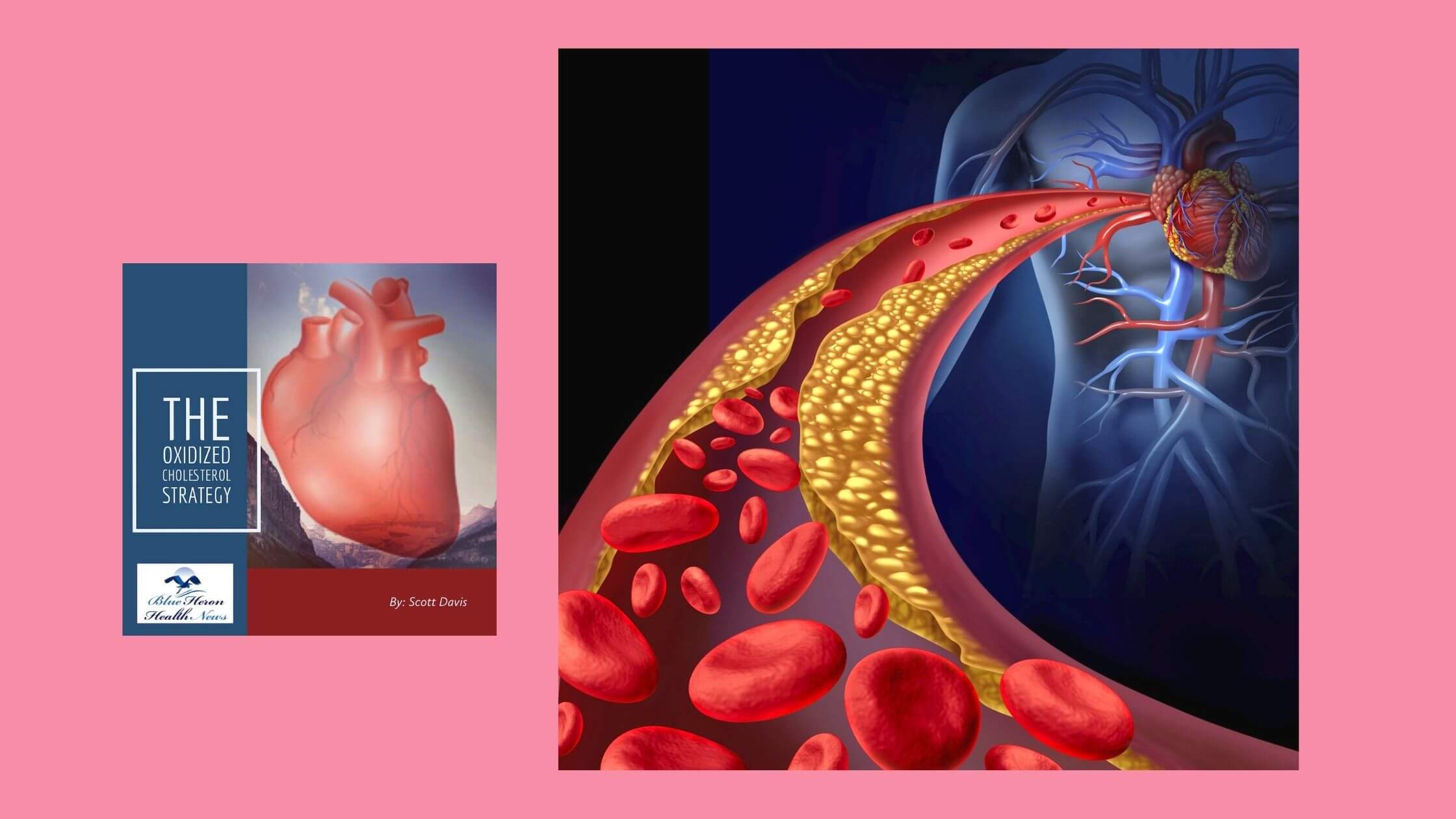 The Oxidized Cholesterol Strategy Benefits