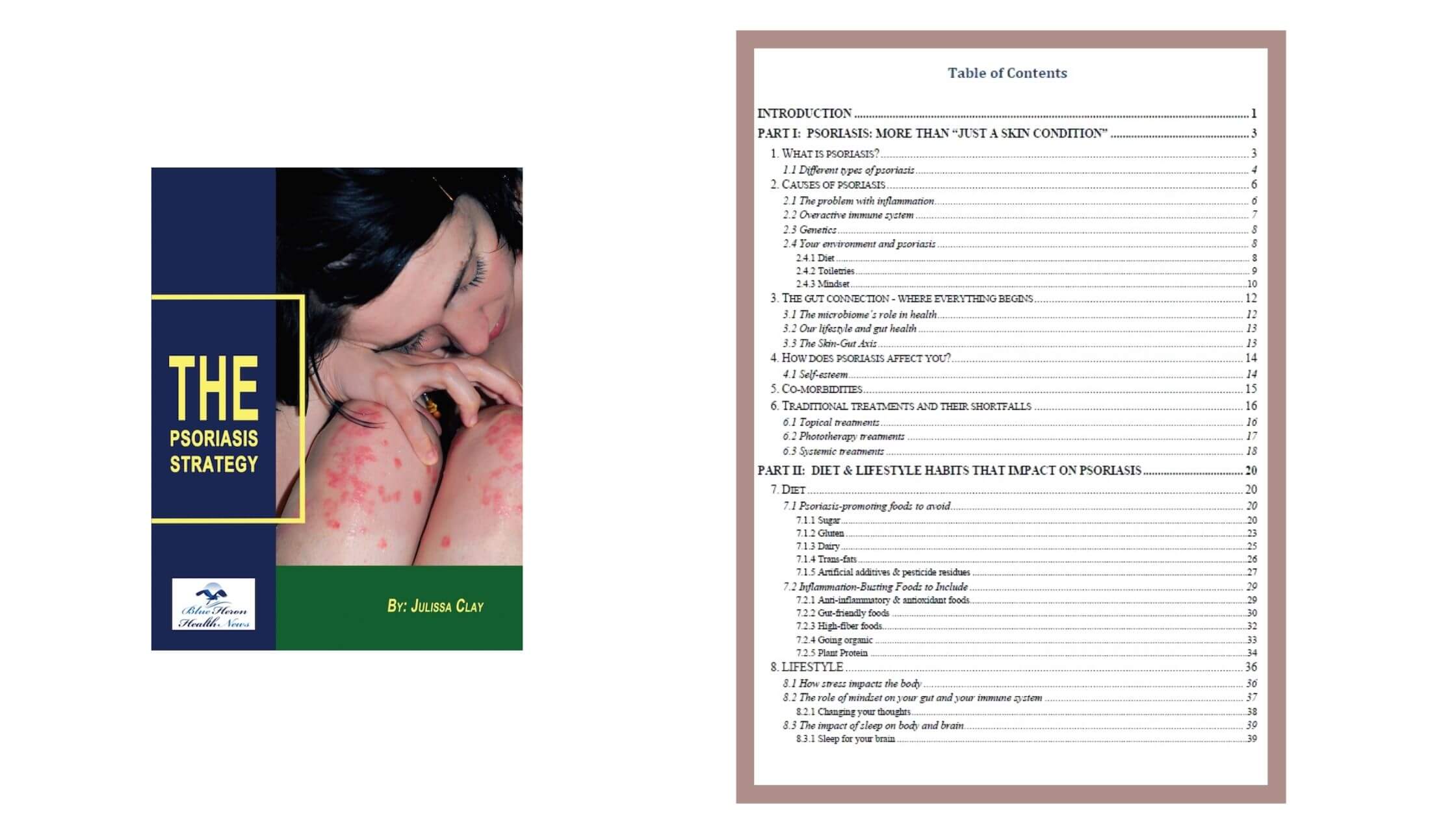  The Psoriasis Strategy Contents