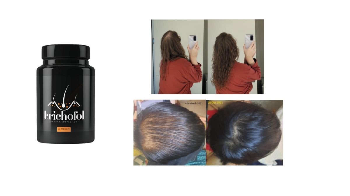 Trichofol Benefits