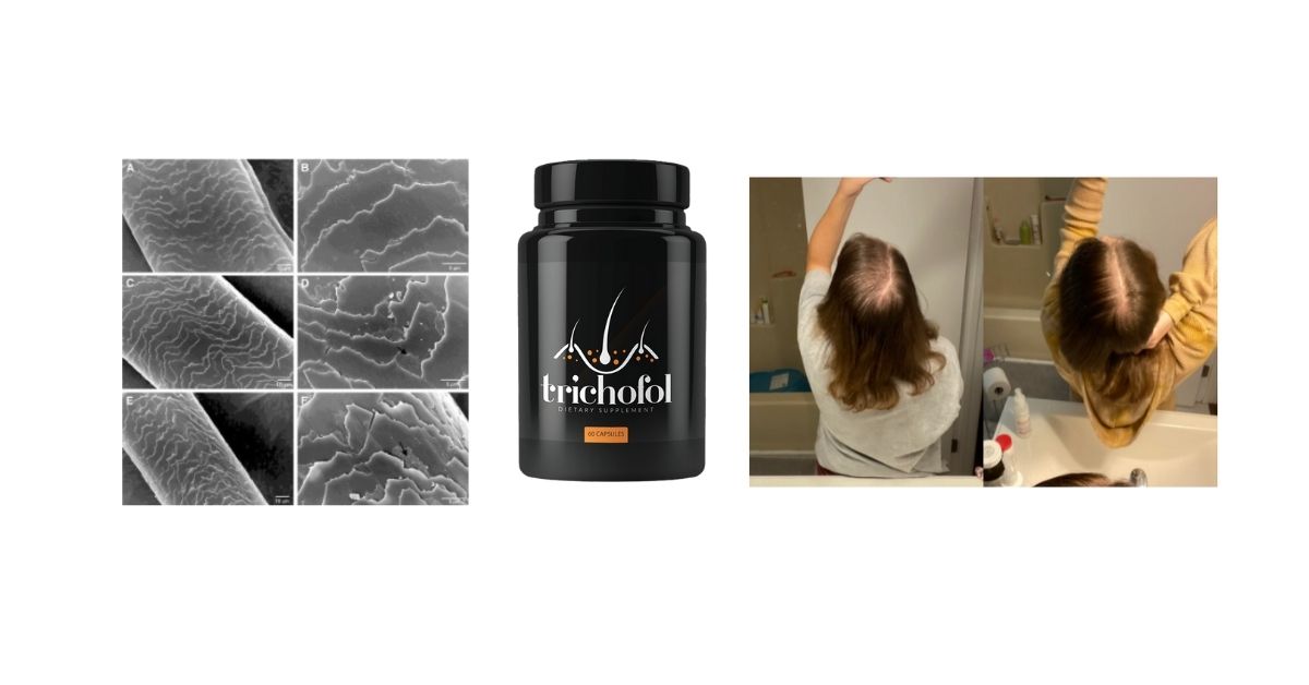 Trichofol Results and Longevity