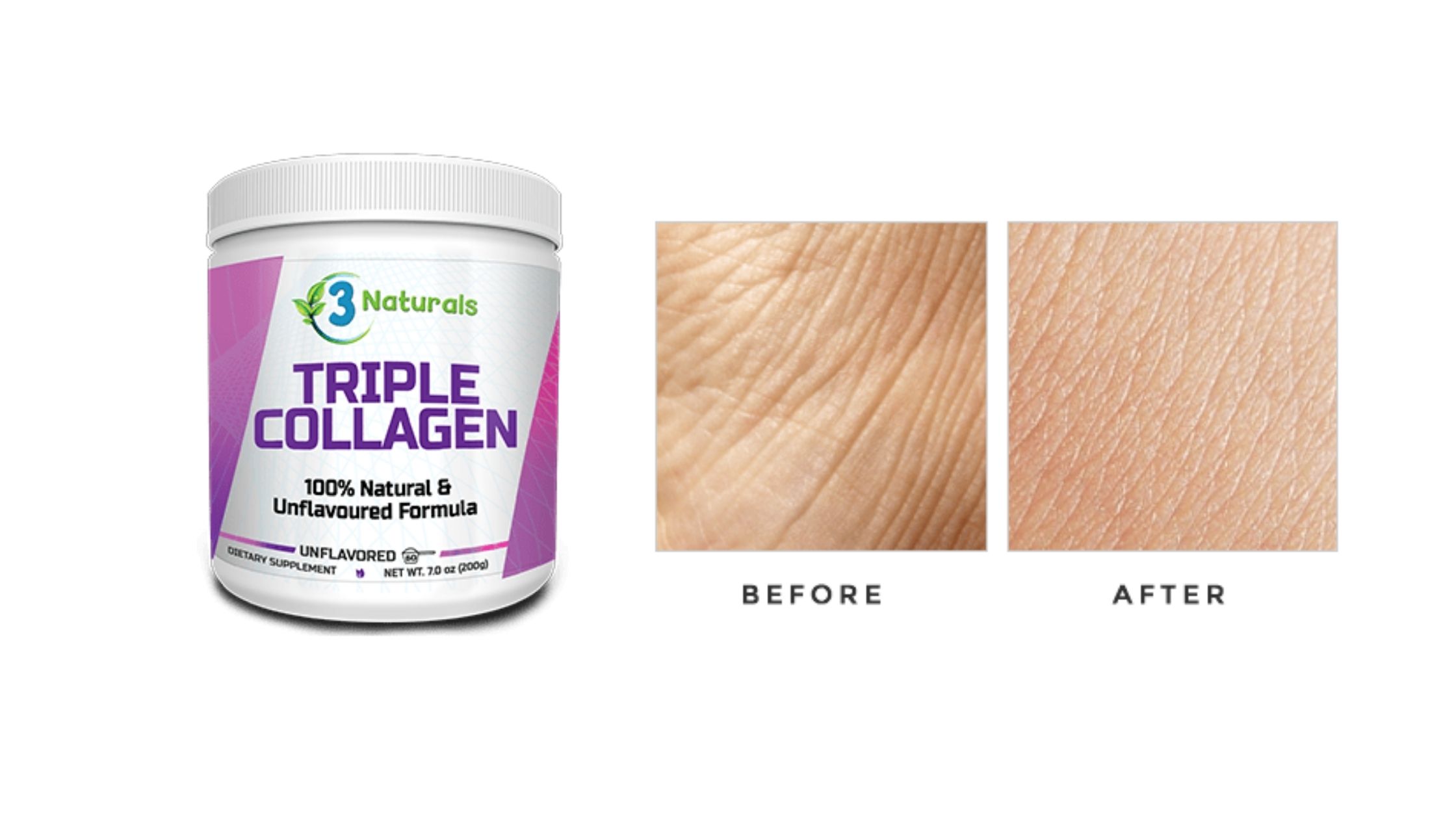 Triple Collagen Working