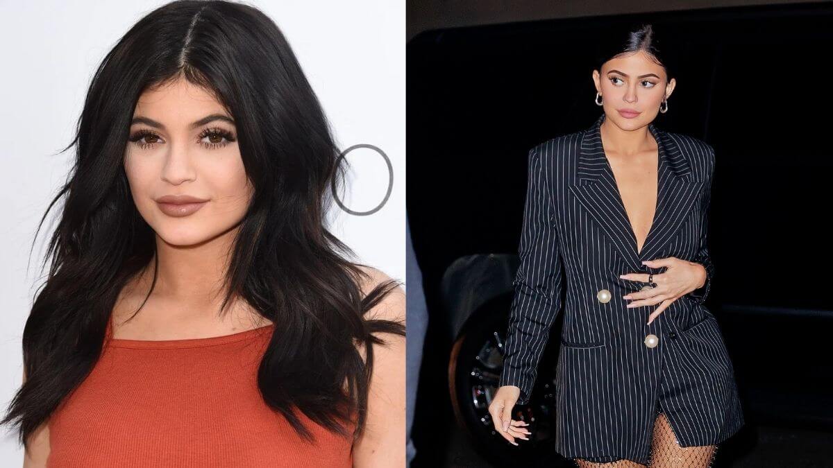 Kylie Jenner Plastic Surgery Transformation